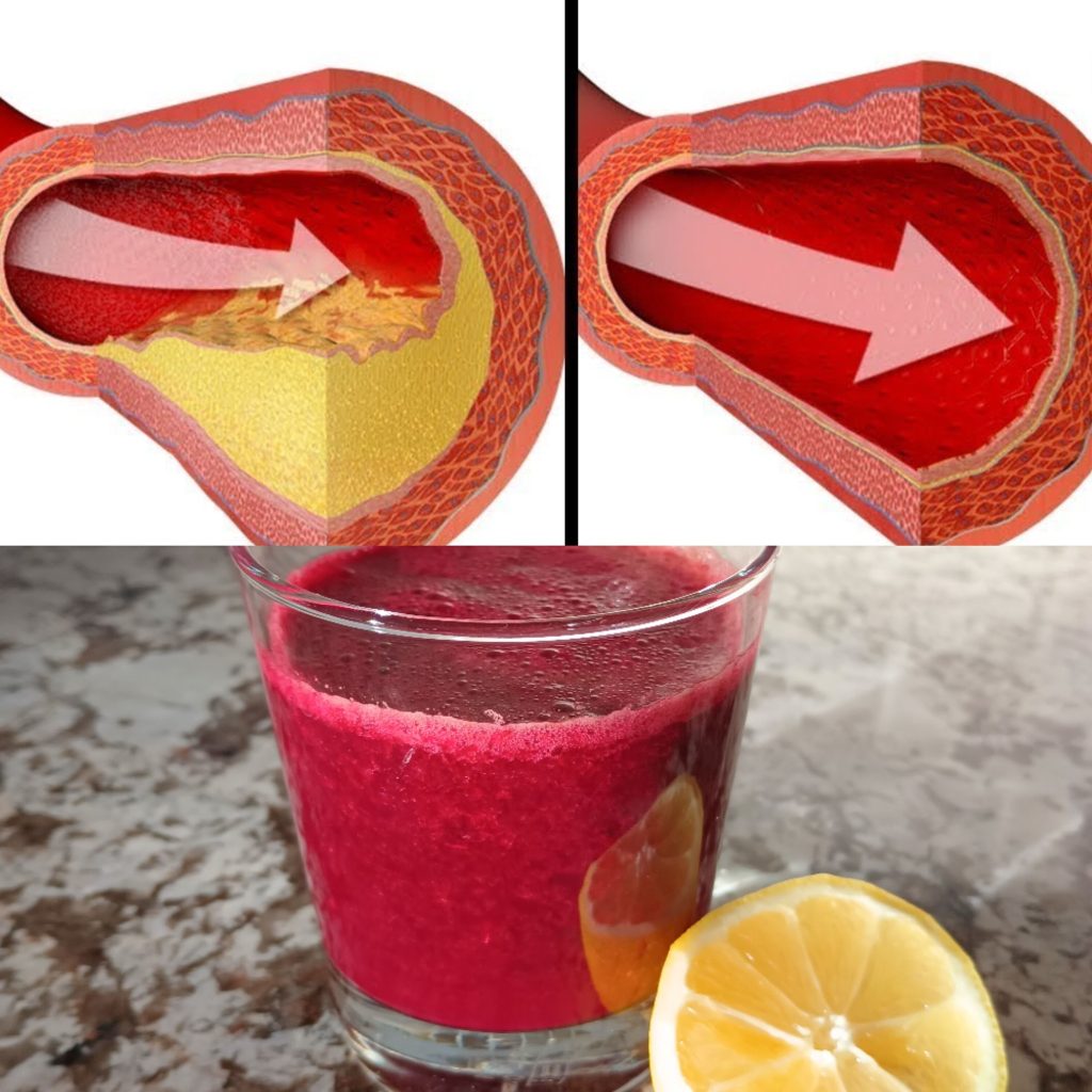 A Glass Of This Juice Everyday… Reverse Clogged Arteries & Lower High Blood Pressure