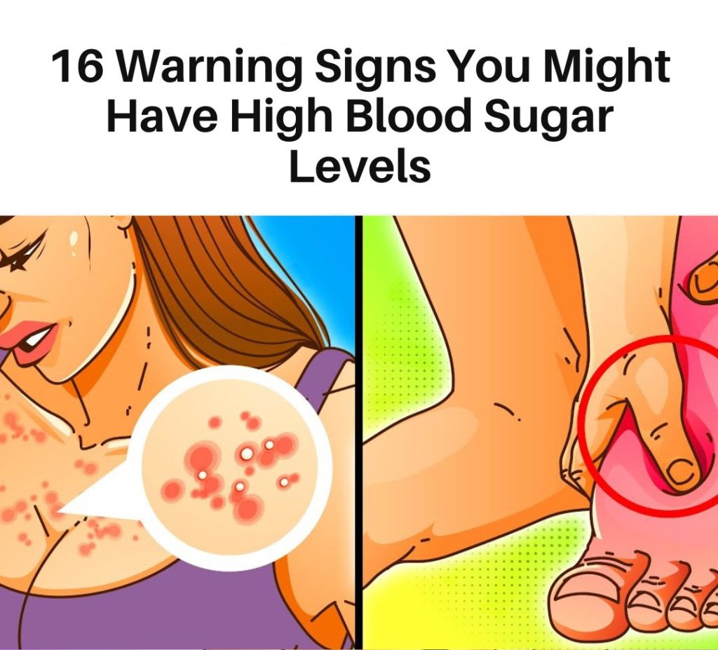 High Blood Sugar Warning Signs