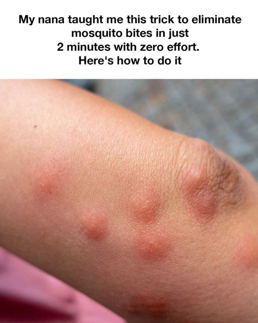 trick to eliminate mosquito bites in just 2 minutes