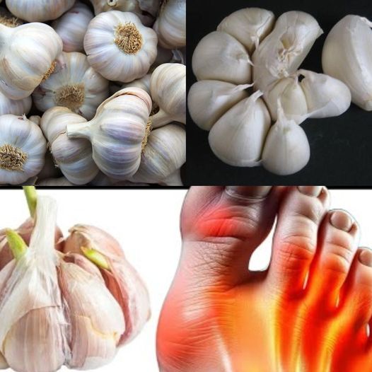 Garlic Removes Gout! Pain, Inflammation, Swelling Disappear if You Do This