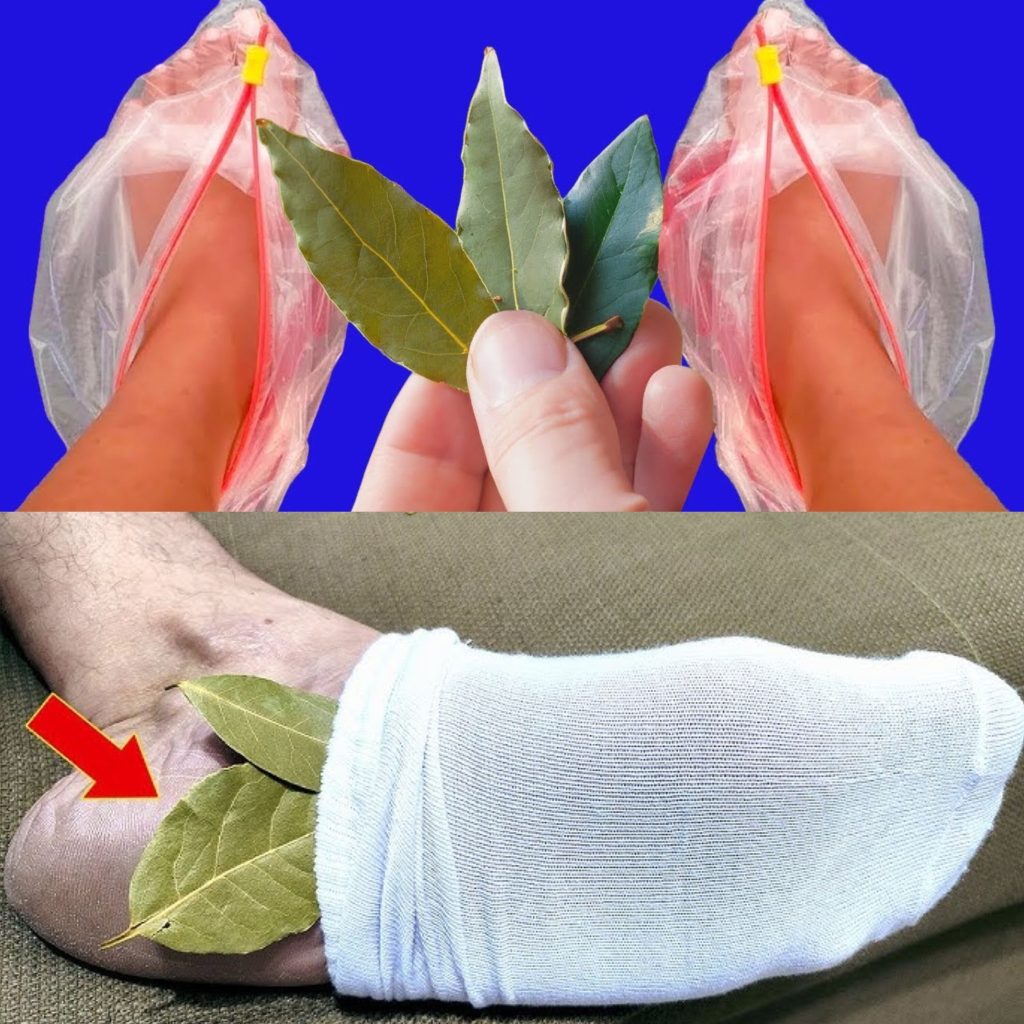 I Put a Bay Leaf on My Feet and Watched What Happened!